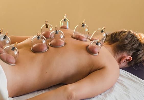 Cupping